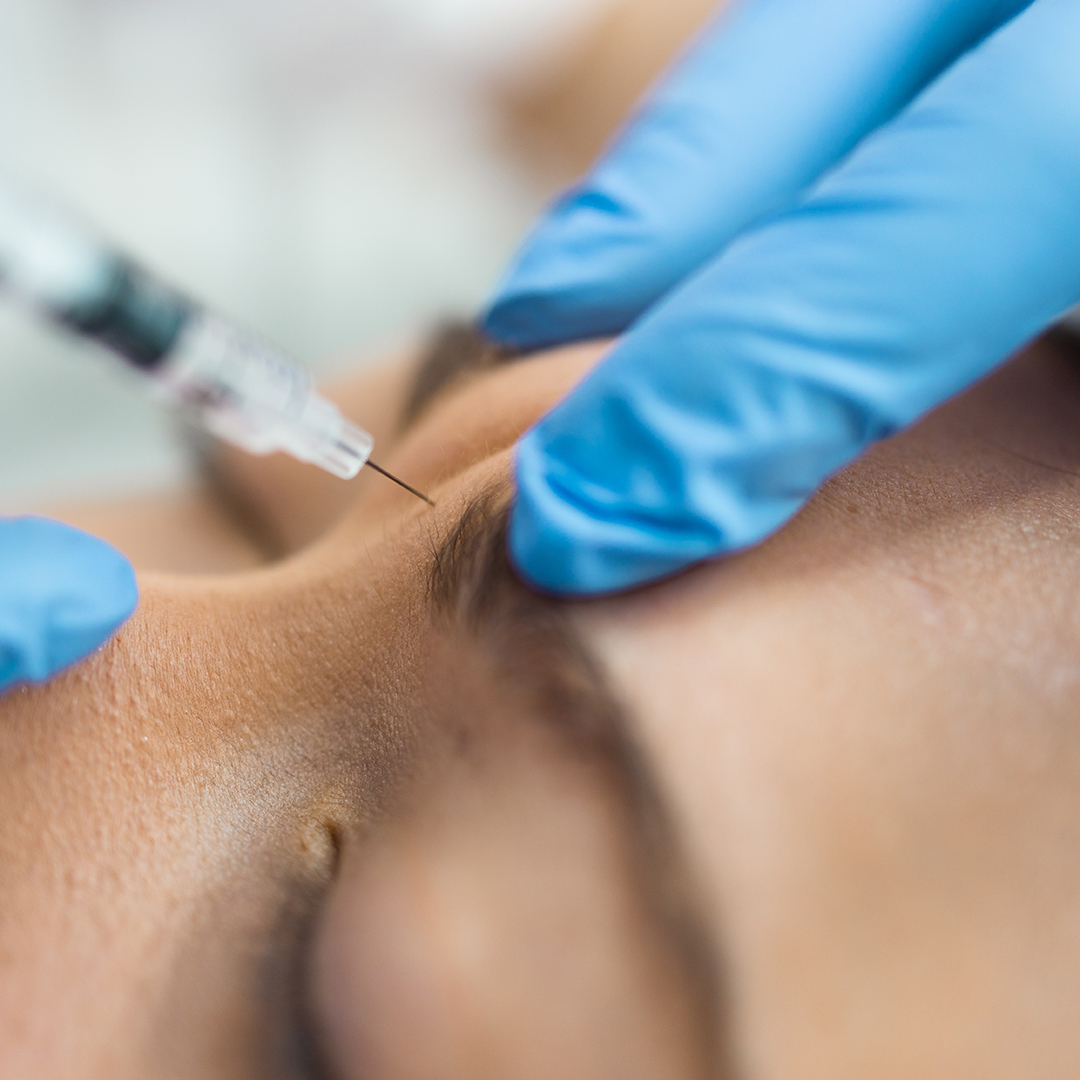 Close up of botox injection in the eyebrow or forehead of female patient