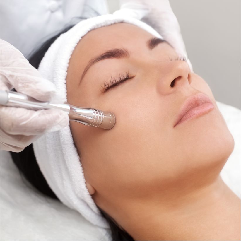 microdermabrasion1